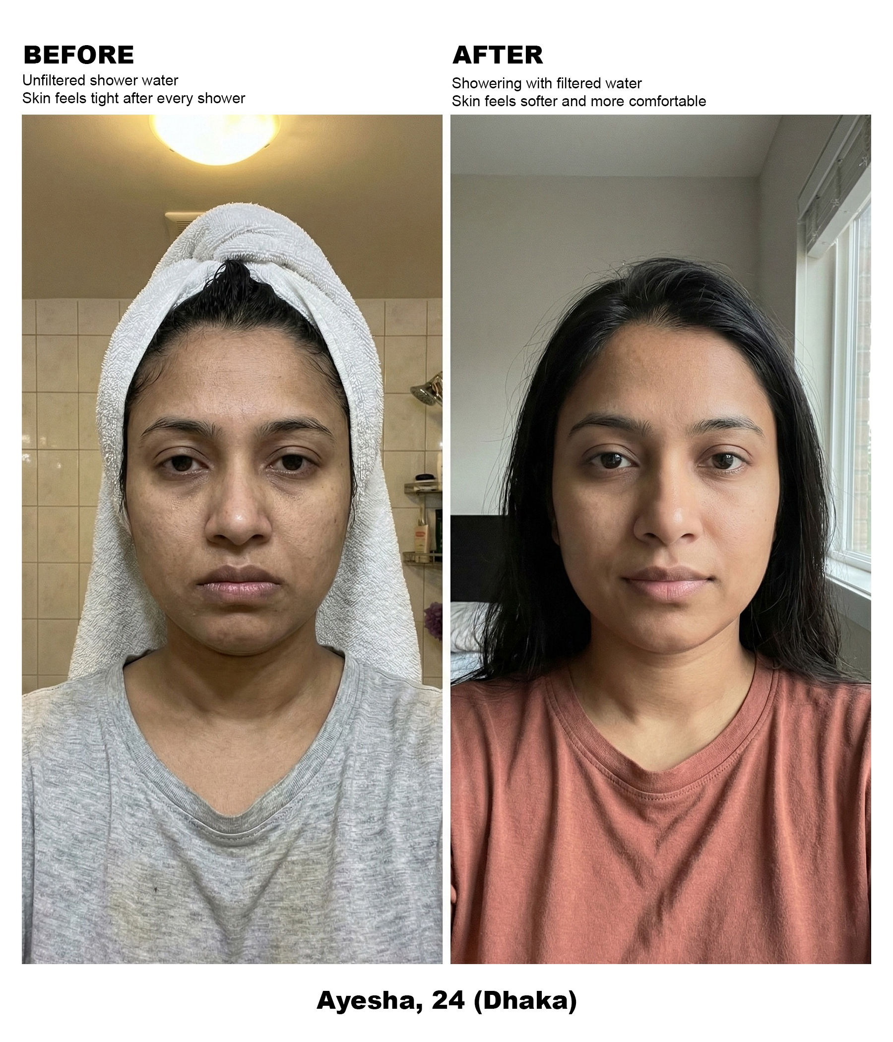 Female, 20s – Dry : Dehydrated Skin