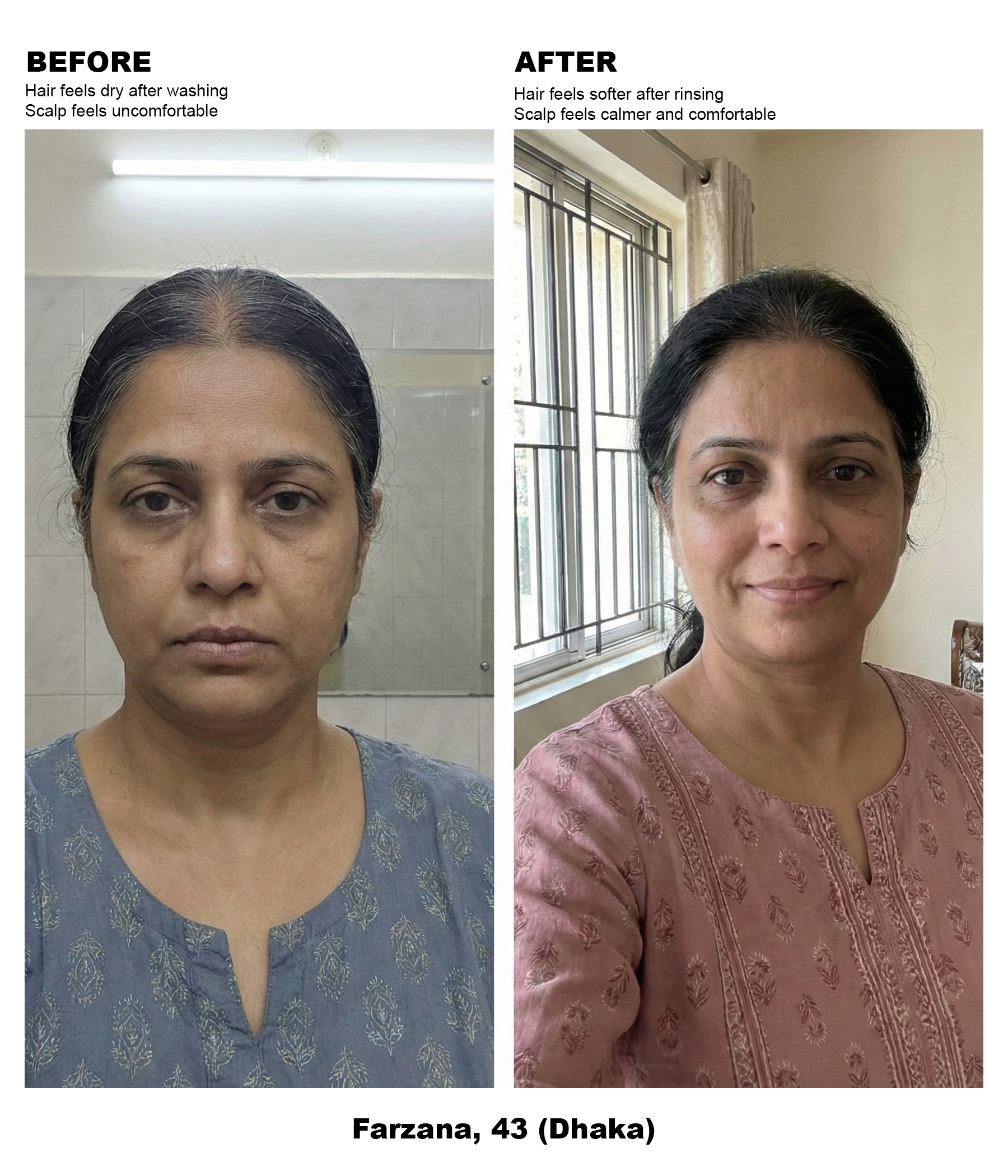 Female, 40s – Dry Hair : Scalp Discomfort