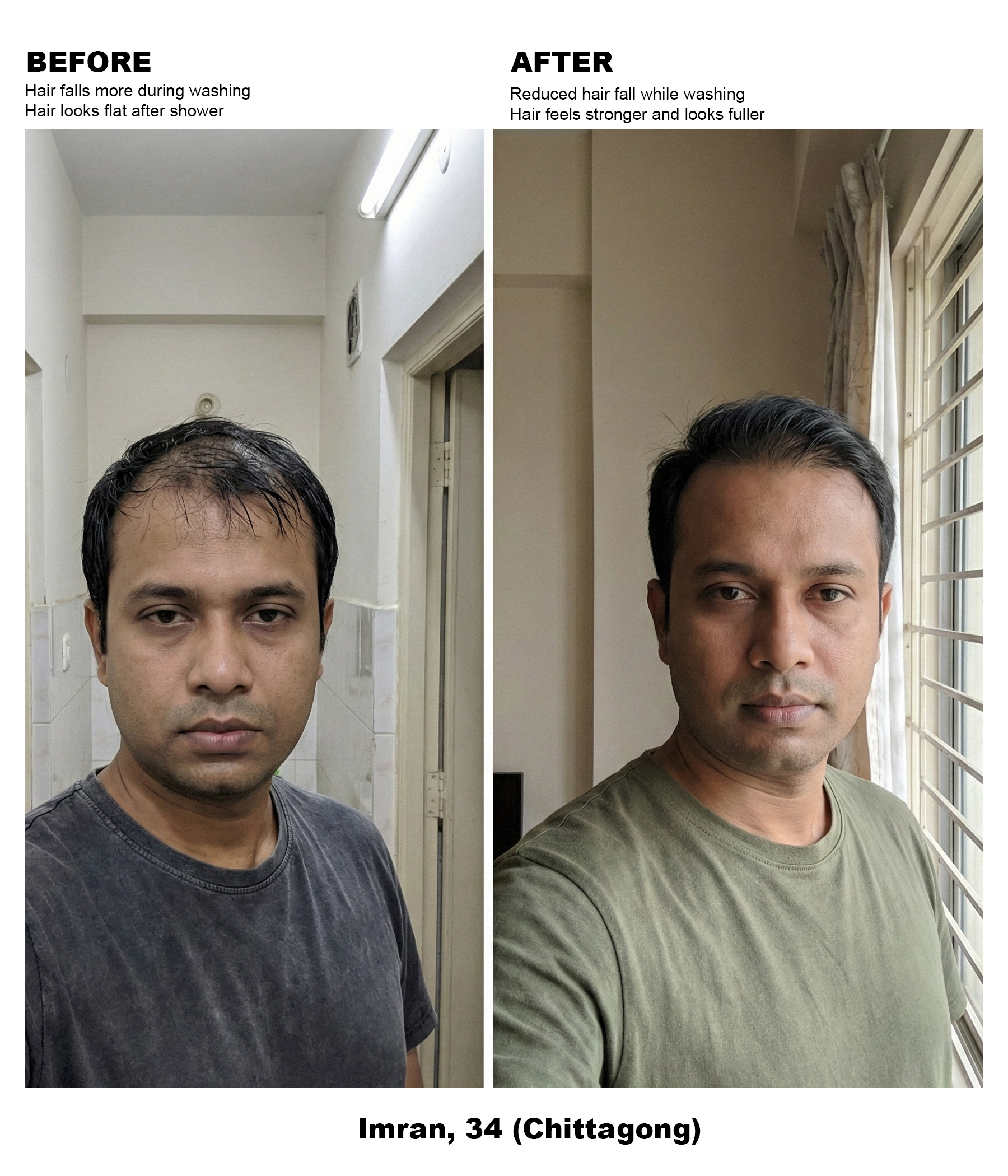 Male, 30s – Flat : Thinning-Looking Hair