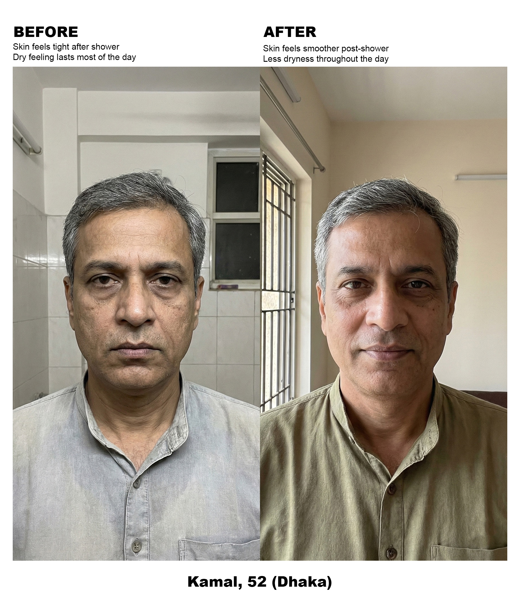 Male, 50s – Dry : Mature Skin